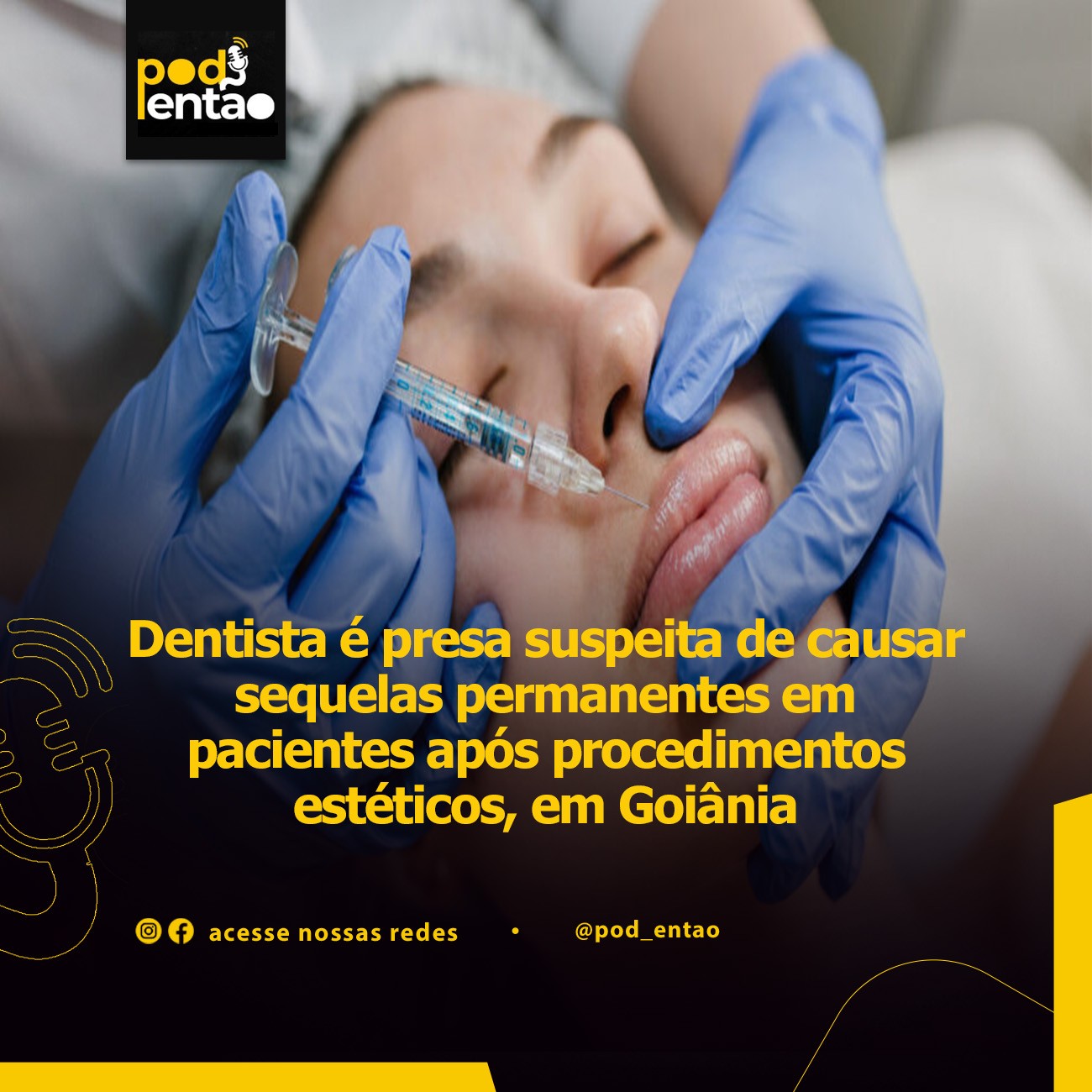 Dentista é presa suspeita de causar sequelas permanentes em pacientes após procedimentos estéticos, em Goiânia